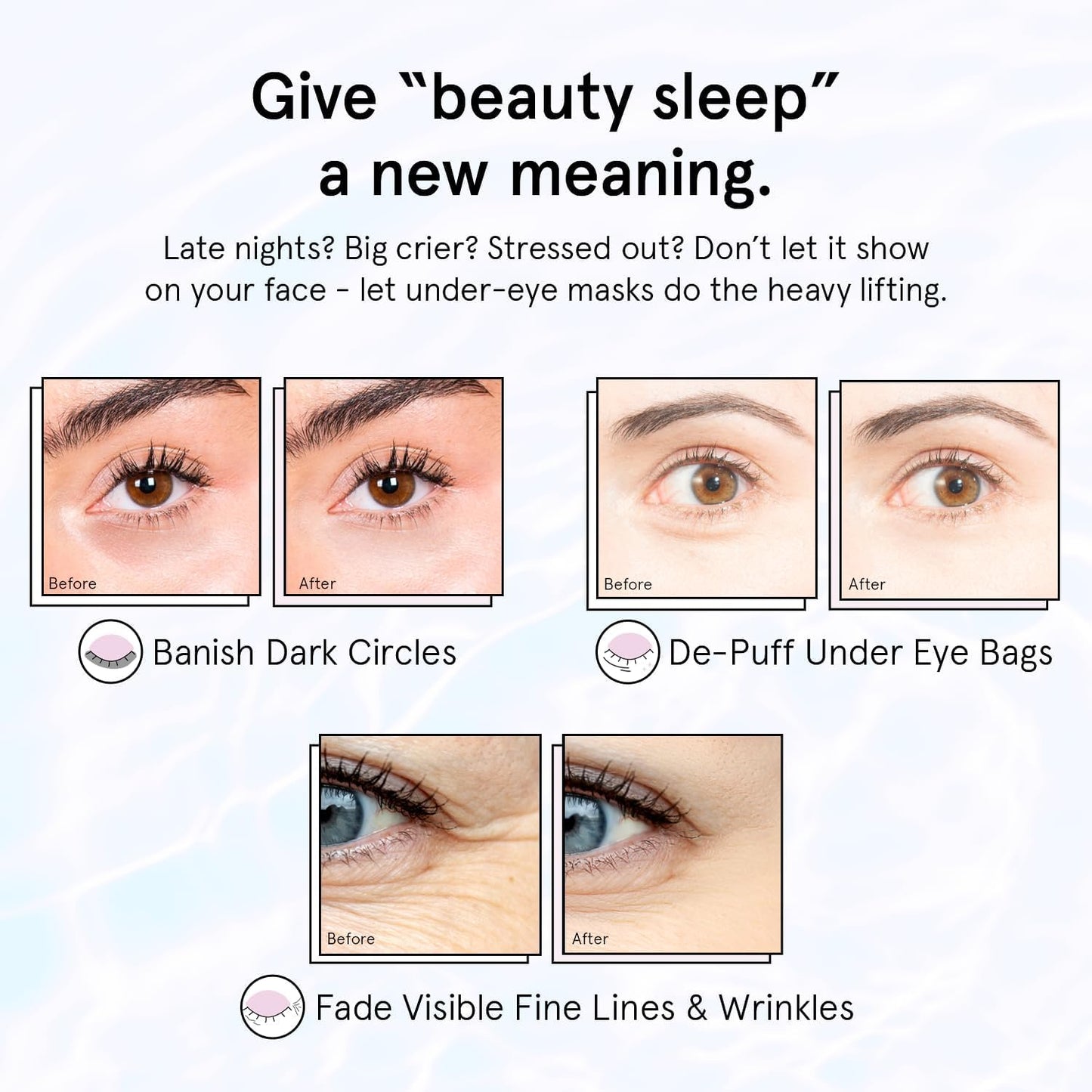 grace & stella Retinol Under Eye Patches for Puffy Eyes & Dark Circles - Restoring Gel Under Eye Masks with Hyaluronic Acid - Birthday Gifts for