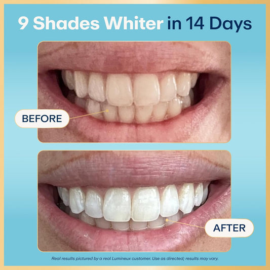 Lumineux Teeth Whitening Strips Kit - 9 Treatments (1 Month) - Peroxide Free - Enamel Safe for Whiter Teeth - Whitening Without The Sensitivity -