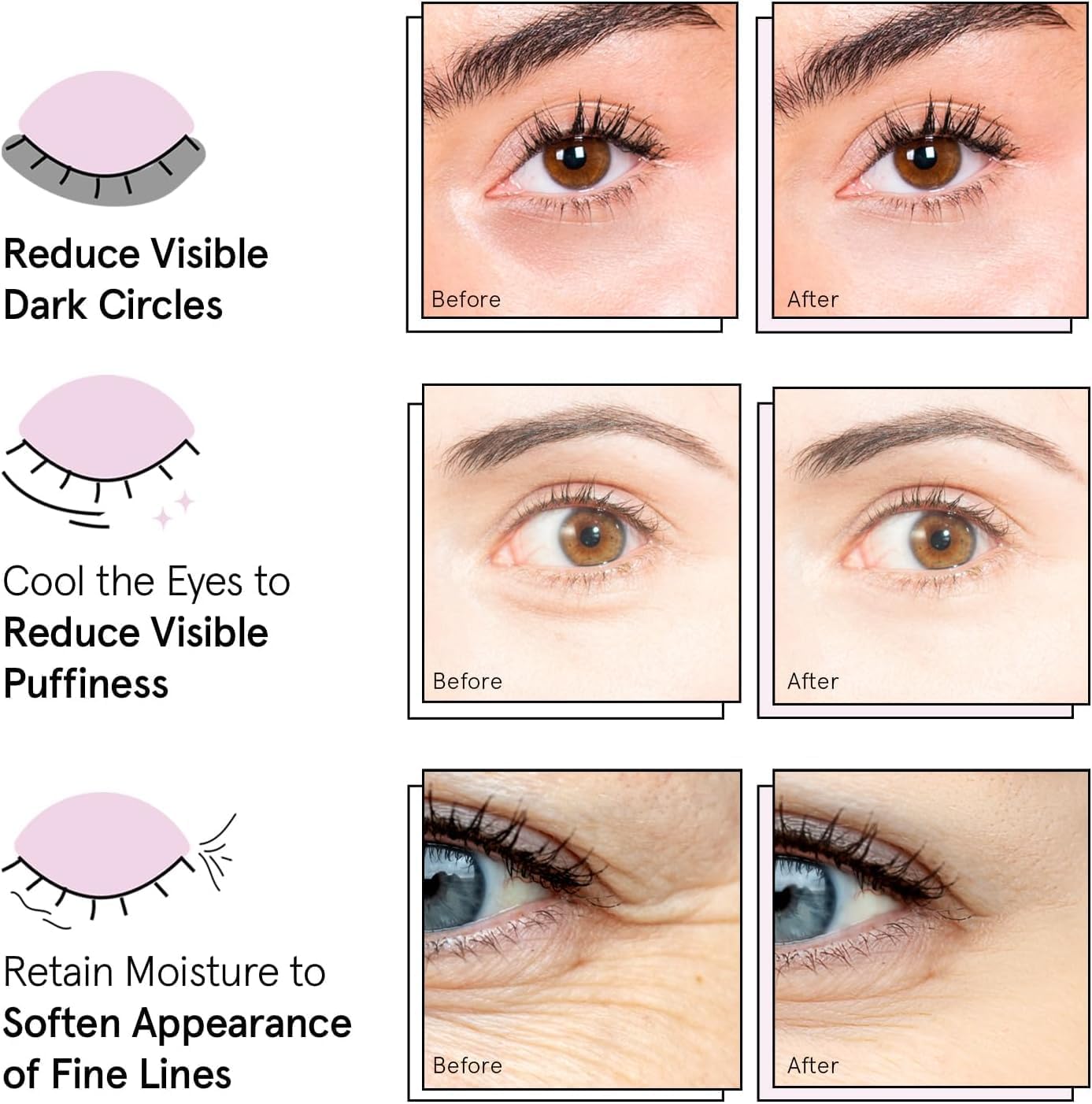 grace & stella Award Winning Under Eye Mask - Reduce Dark Circles, Puffy Eyes, Undereye