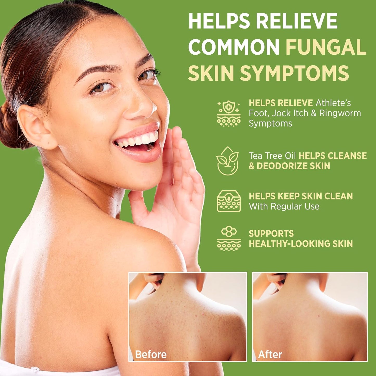 Roycederm Antifungal Bar Soap - Tea tree Oil Soap - Athletes Foot Treatment for Jock Itch & Ringworm - Medicated Antifungal Soap with Clotrimazole 1%