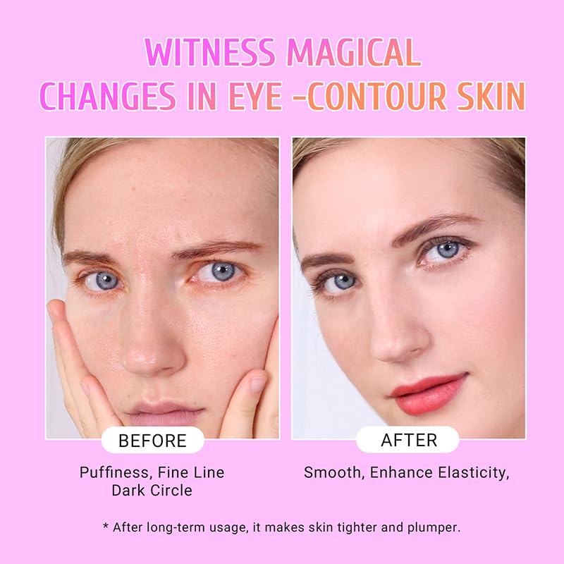 PEAUAMIE Under Eye Patches Gold and Hyaluronic Acid for puffy