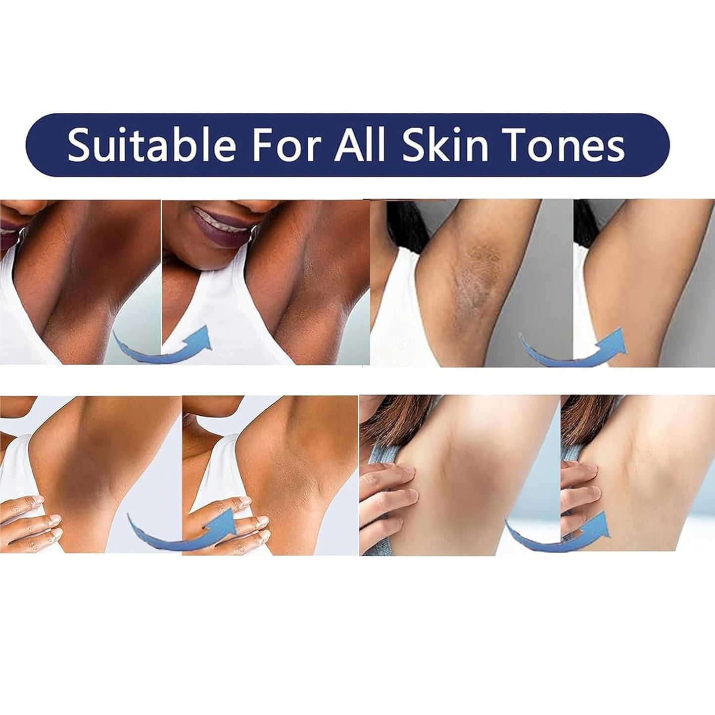 Skin Bleaching Cream Skin Lightening for Body Intimate Areas, Private Parts, Underarm, Knees, Elbows, Inner Thigh, Bikini