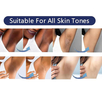 Skin Bleaching Cream Skin Lightening for Body Intimate Areas, Private Parts, Underarm, Knees, Elbows, Inner Thigh, Bikini