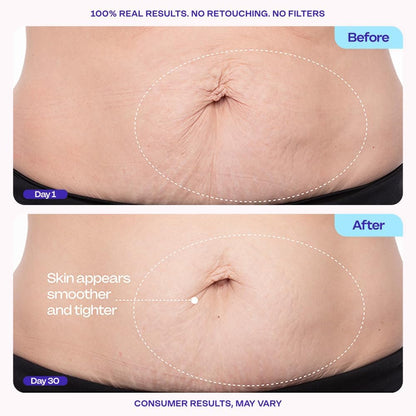 goPure Firming Belly Cream - Dermatologist-Developed Moisturizer with MicroTight4 Complex - Green Microalgae, Longan