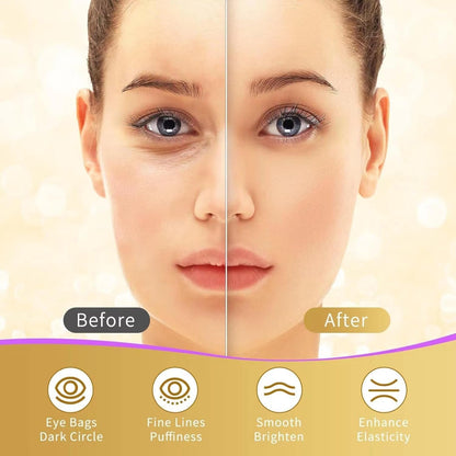 Under Eye Patches, 40 Pairs Eye Mask for Dark Circles, Puffy Eyes, Undereye Bags,Wrinkles,Eye Mask Patches with 24K Gold, Hyaluronic