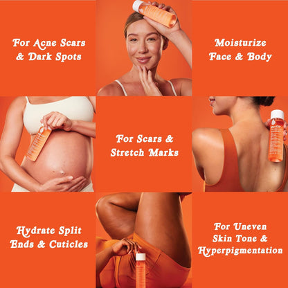 Bio-Oil Skincare Body Oil Serum, Face and Body Moisturizer with Vitamin E & A, for Scars, Stretch Marks, Sensitive Skin, All Skin