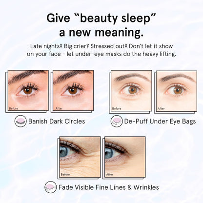 grace & stella Retinol Under Eye Patches for Puffy Eyes & Dark Circles - Restoring Gel Under Eye Masks with Hyaluronic Acid - Birthday Gifts for