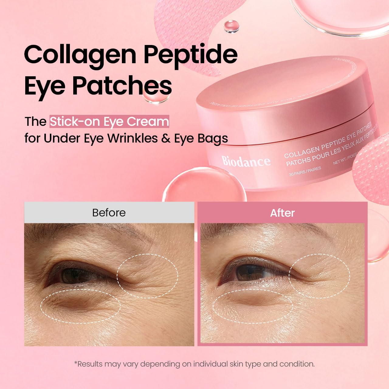 BIODANCE Collagen Peptide Eye Patches, Anti Wrinkle & Smile Line Patches for Face, Under Eye Mask for Fine Lines & Eye