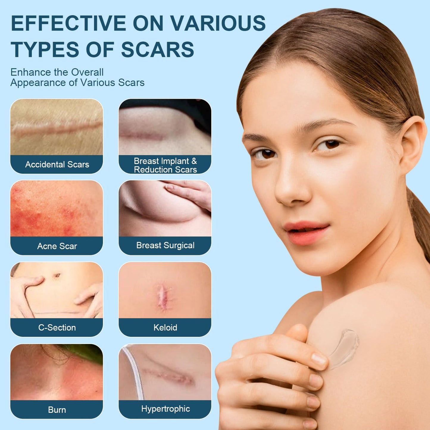 Mitgary Advanced Scar Gel, Silicone Scar Gel, Treats Old and New Scars, Reduces the Appearance of Scars from, Body, Face, Stretch