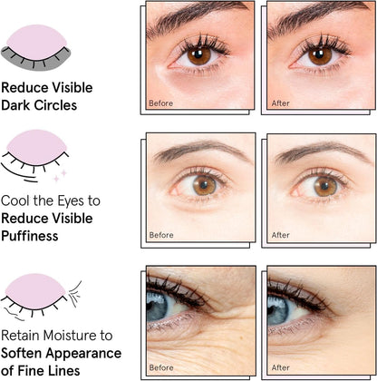 grace & stella Award Winning Under Eye Mask - Reduce Dark Circles, Puffy Eyes, Undereye