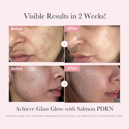 medicube Salmon DNA PDRN Trial Kit, Glass Glow Mini Skincare Set with Toner, Serum & Sheet Mask for Hydrating