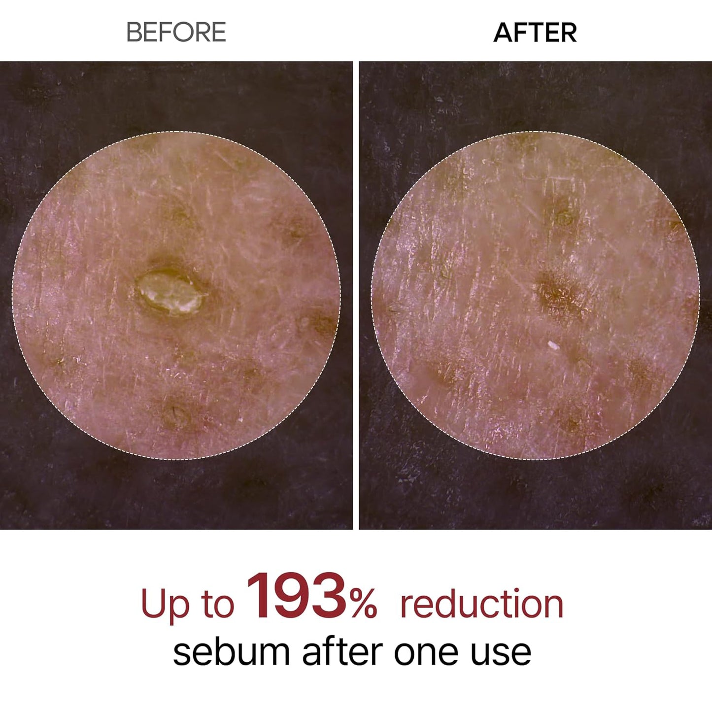 Dr.Melaxin Peel Shot Glow White Rice Peeling Ampoule with Rice Extract & AHA BHA, Brightening & Gentle Exfoliating Serum for Sebum