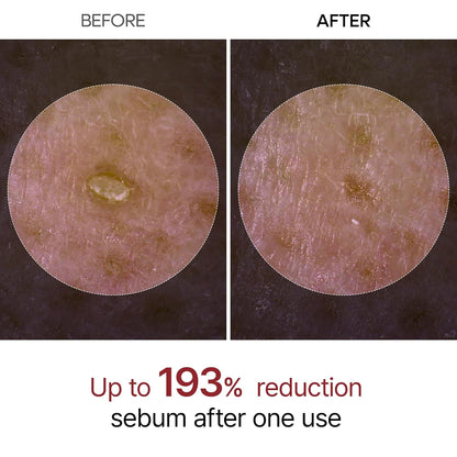 Dr.Melaxin Peel Shot Glow White Rice Peeling Ampoule with Rice Extract & AHA BHA, Brightening & Gentle Exfoliating Serum for Sebum