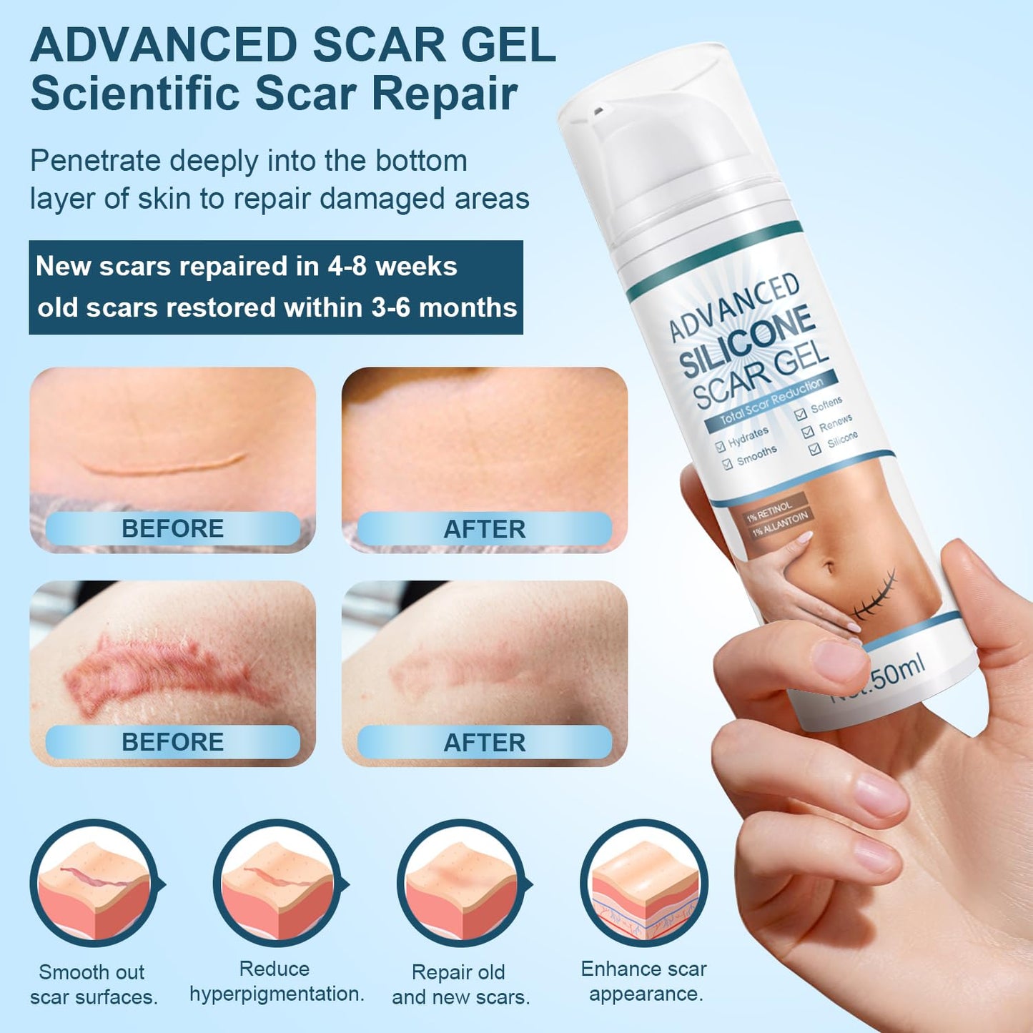 Mitgary Advanced Scar Gel, Silicone Scar Gel, Treats Old and New Scars, Reduces the Appearance of Scars from, Body, Face, Stretch
