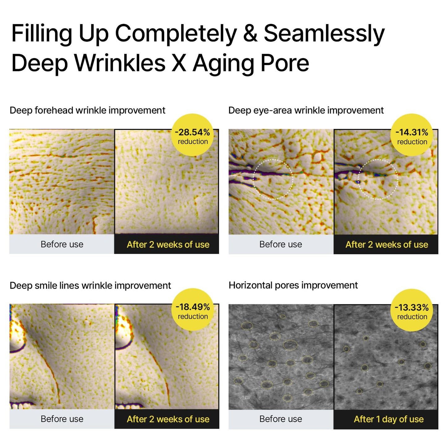 celimax The Vita A Retinal Shot Tightening Booster, 0.1% Retinal, 3% Matryxyl, High-Strength Retinoid for Anti-Aging, Pore