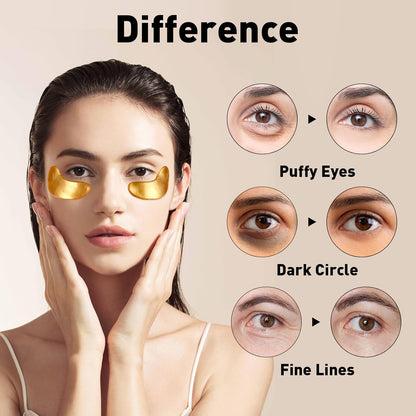CHMI Under Eye Patches (50 Pairs) - 24K Gold Eye Patches for Puffy Eyes, Dark Circles, EyeBags and Wrinkles, Collagen Skin Care