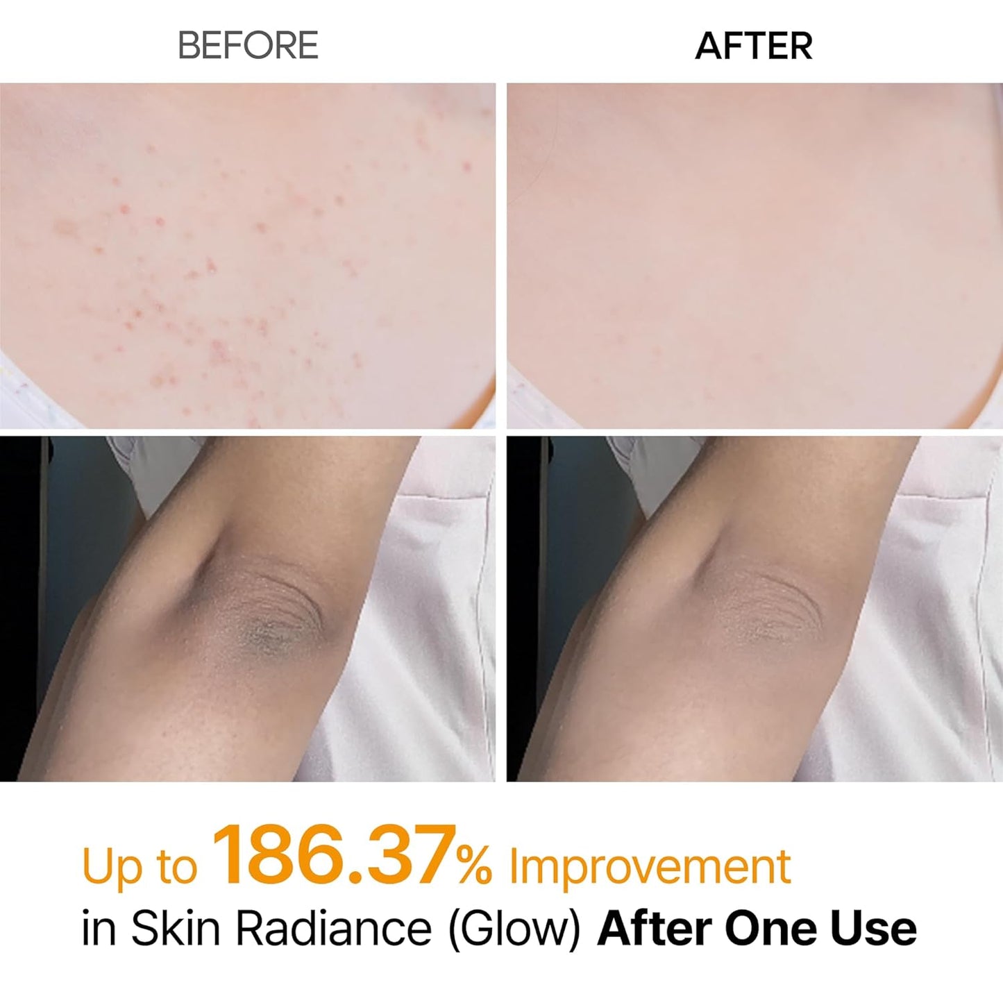 Dr.Melaxin Body Keratin Care Kojic Acid Turmeric Spray with AHA &