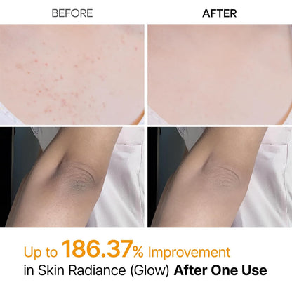 Dr.Melaxin Body Keratin Care Kojic Acid Turmeric Spray with AHA &