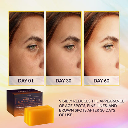VALITIC Kojic Acid Dark Spot Remover Soap Bars with Vitamin C, Retinol, Collagen, Turmeric - Original Japanese Complex Infused with Hyaluronic