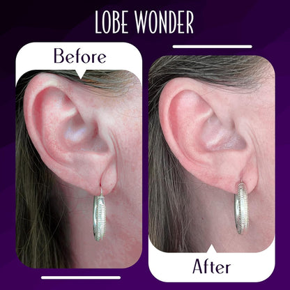 Lobe Wonder - The ORIGINAL Ear Lobe Support Patch for Pierced Ears - Eliminates the Look of Torn or Stretched Piercings - Protects Healthy Ear Lobes