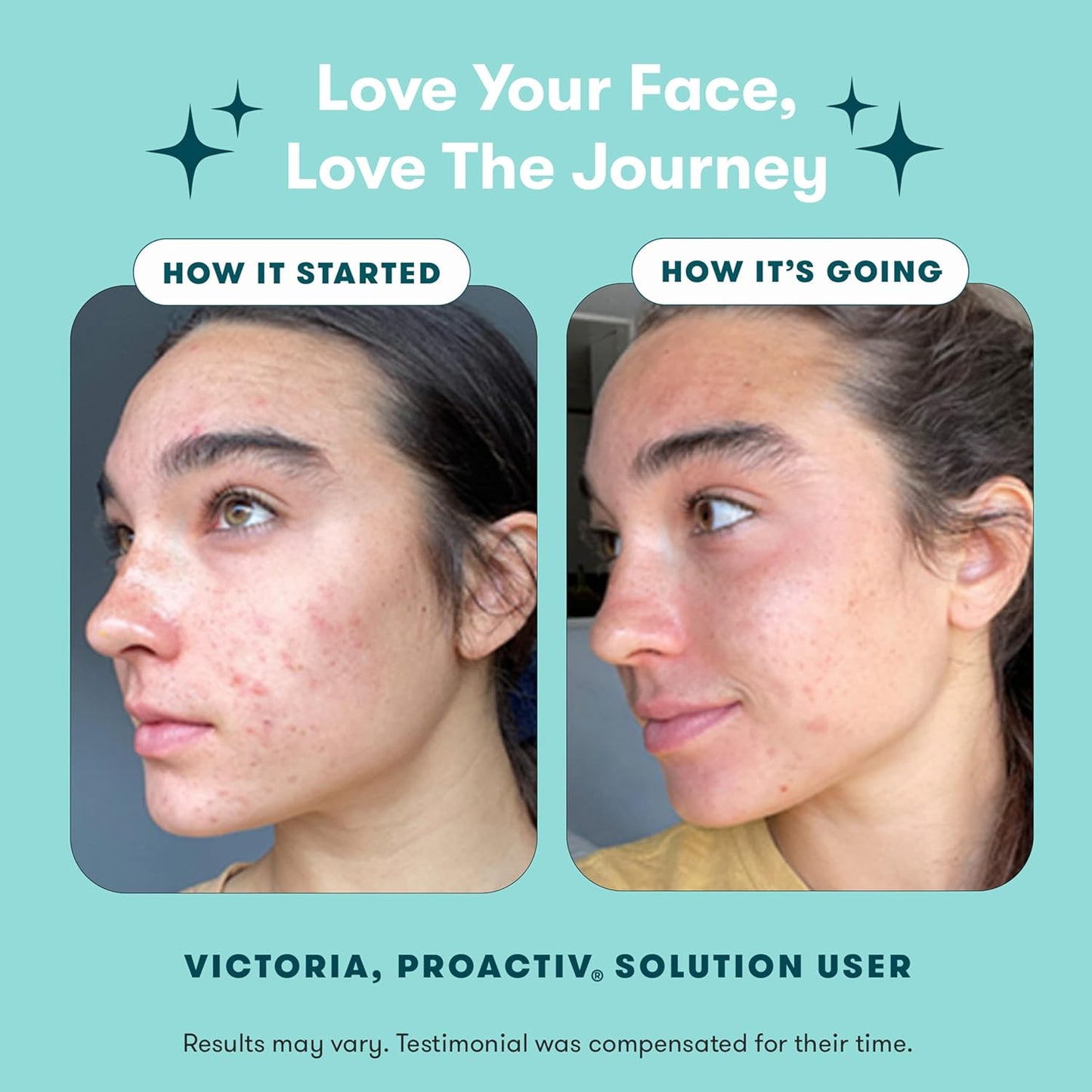 Proactiv 3 Step Acne Treatment - Benzoyl Peroxide Face Wash, Repairing Acne Spot Treatment for Face and