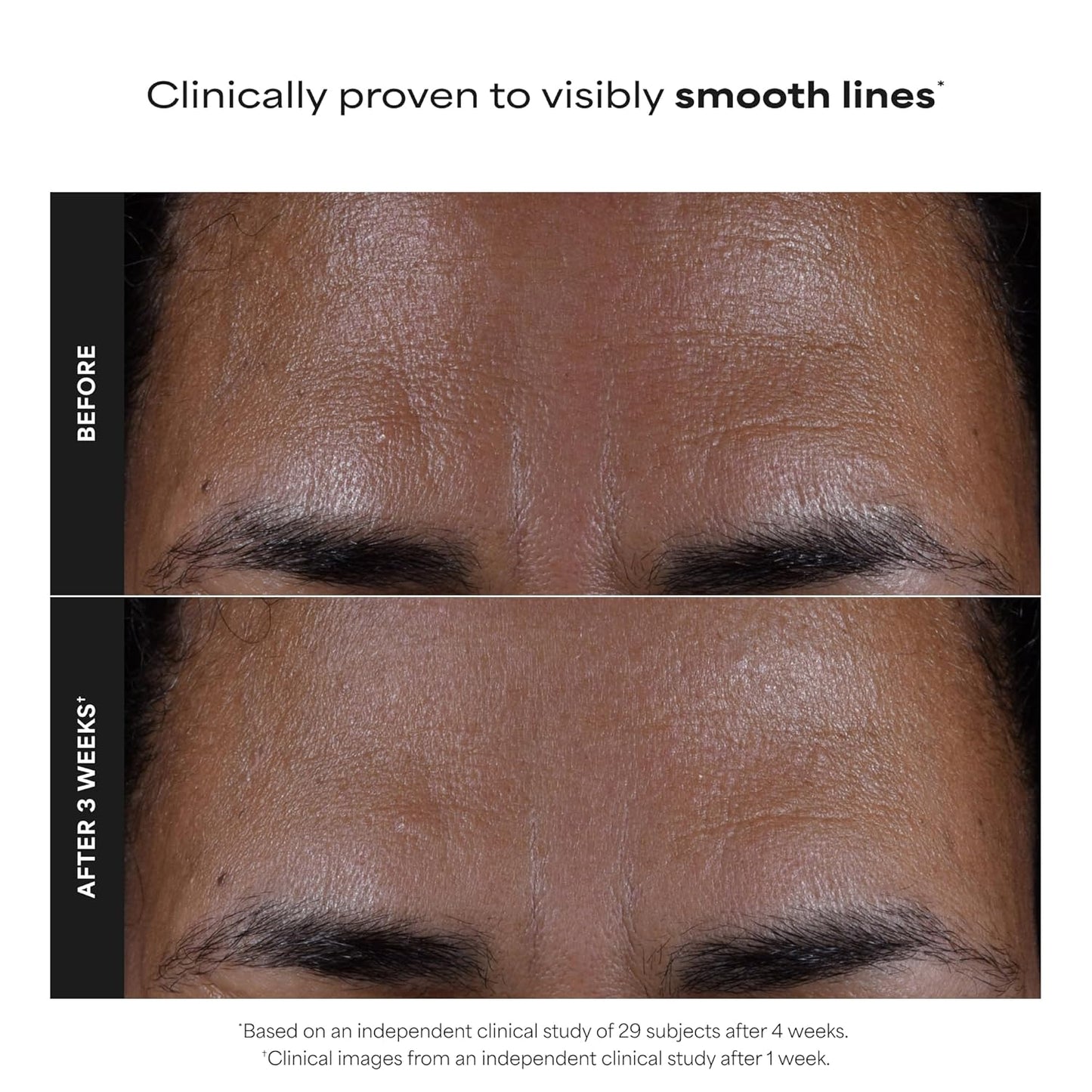 Paula's Choice SKIN PERFECTING 2% BHA Liquid Exfoliant with Salicylic Acid, Facial Polish for Enlarged Pores, Wrinkles & Fine