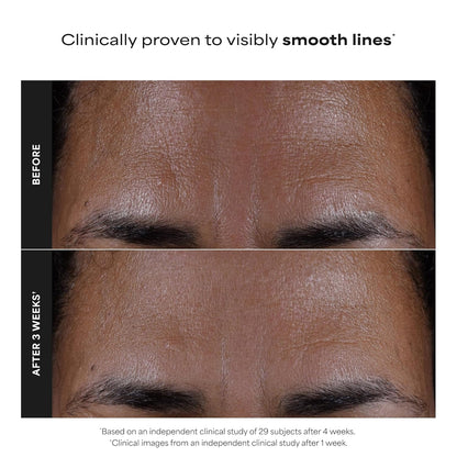 Paula's Choice SKIN PERFECTING 2% BHA Liquid Exfoliant with Salicylic Acid, Facial Polish for Enlarged Pores, Wrinkles & Fine