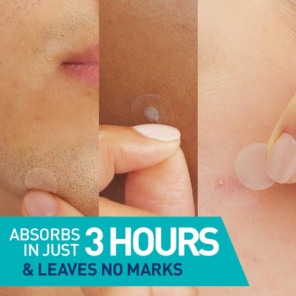 CeraVe Hydrocolloid Blemish Patches, Oil Absorbing Spot Control with Ceramides and Niacinamide, Allergy-Tested & Suitable For Sensitive